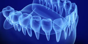 dental imaging of teeth